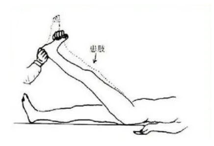 直腿抬高試驗 直腿抬高試驗