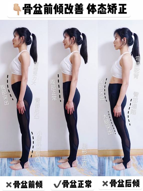 骨盆傾斜 骨盆傾斜